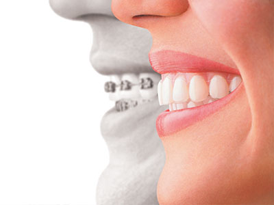 The image displays a split-screen photograph with two faces on each side one face shows a healthy set of teeth, while the other appears to have a damaged tooth that has been repaired with dental implants, emphasizing the transformation achieved through dental care.